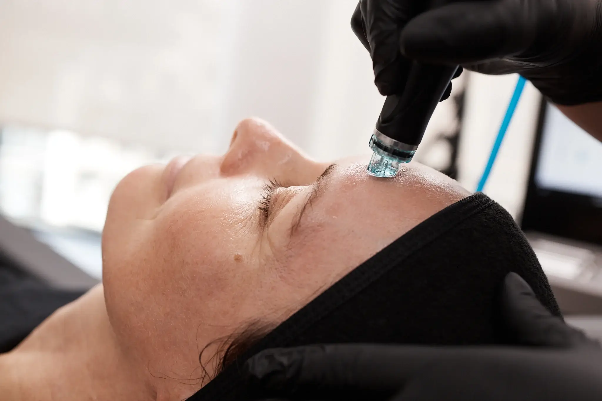 Hydra Facial